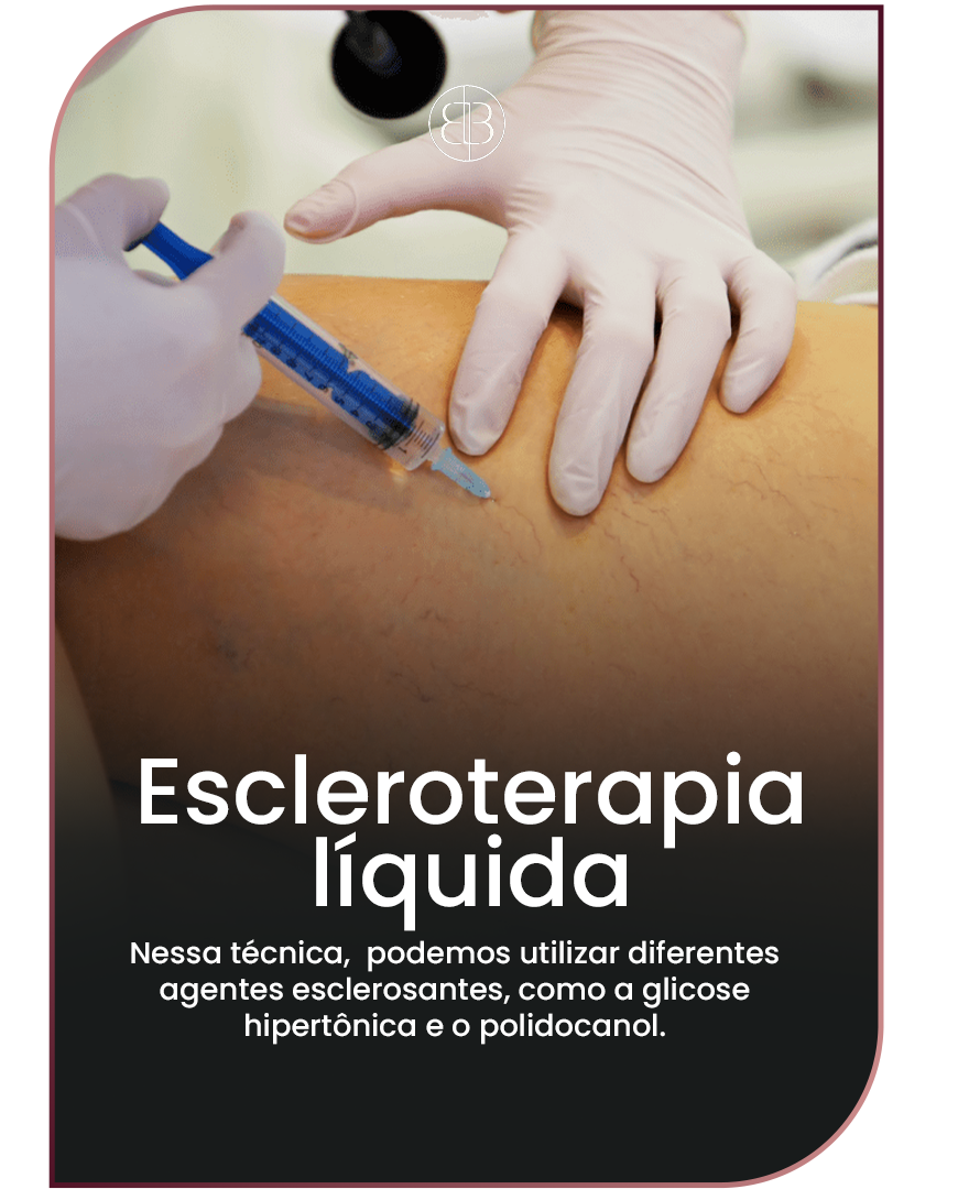 Escleroterapia líquida
