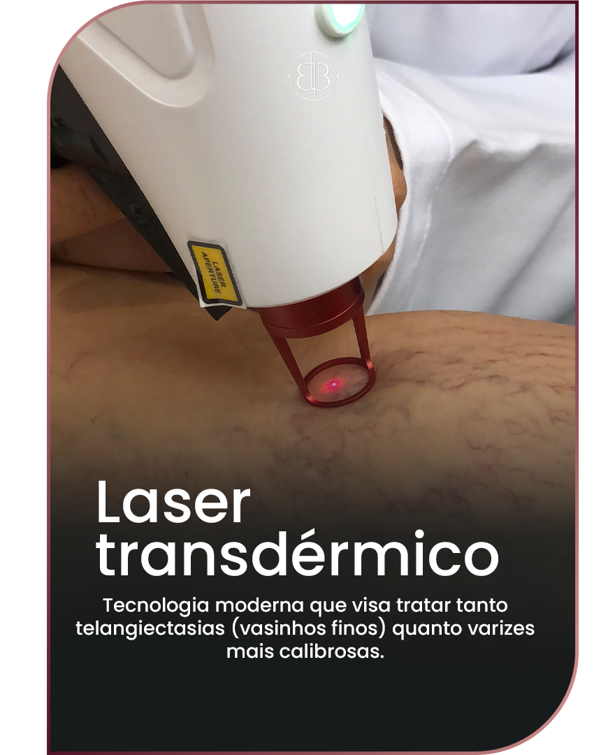 Laser_